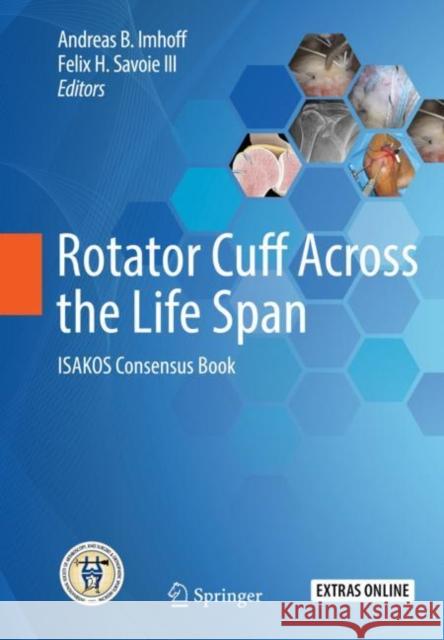 Rotator Cuff Across the Life Span: Isakos Consensus Book Imhoff, Andreas B. 9783662587287