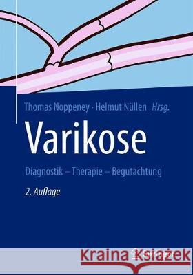 Varikose: Diagnostik - Therapie - Begutachtung Noppeney, Thomas 9783662591161 Springer