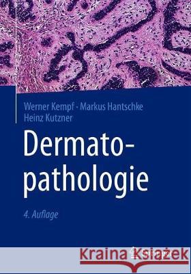 Dermatopathologie Werner Kempf Markus Hantschke Heinz Kutzner 9783662592397