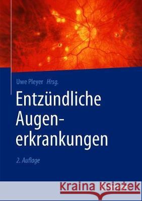 Entzündliche Augenerkrankungen Uwe Pleyer 9783662603987