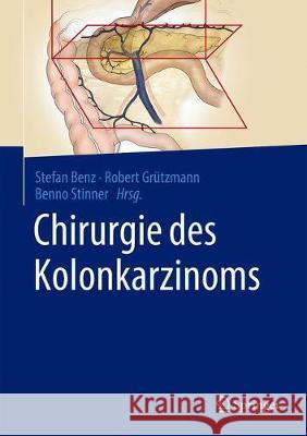 Chirurgie Des Kolonkarzinoms Benz, Stefan 9783662604526 Springer