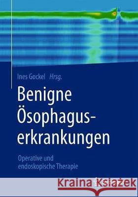 Benigne Ösophaguserkrankungen: Operative Und Endoskopische Therapie Gockel, Ines 9783662604540 Springer