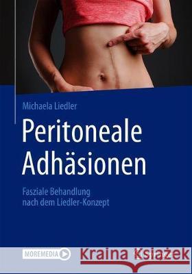 Peritoneale Adhäsionen: Fasziale Behandlung Nach Dem Liedler-Konzept Liedler, Michaela 9783662604991 Springer