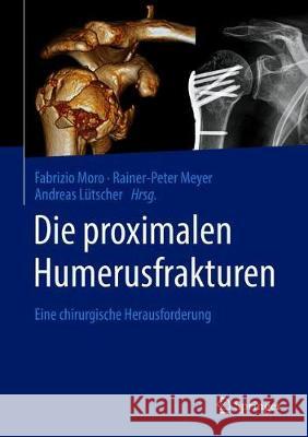 Die Proximalen Humerusfrakturen: Eine Chirurgische Herausforderung Moro, Fabrizio 9783662608524