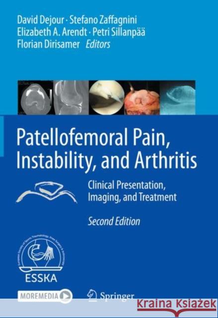 Patellofemoral Pain, Instability, and Arthritis: Clinical Presentation, Imaging, and Treatment Dejour, David 9783662610961 Springer