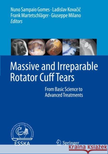 Massive and Irreparable Rotator Cuff Tears: From Basic Science to Advanced Treatments Sampaio Gomes, Nuno 9783662611616 Springer