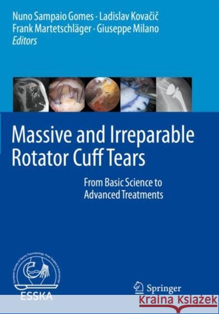 Massive and Irreparable Rotator Cuff Tears: From Basic Science to Advanced Treatments Nuno Sampai Ladislav Kovačič Frank Martetschl 9783662611647 Springer
