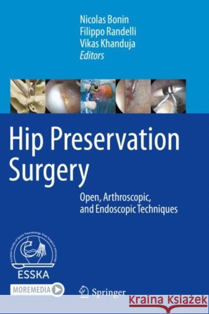 Hip Preservation Surgery: Open, Arthroscopic, and Endoscopic Techniques Bonin, Nicolas 9783662611852 Springer