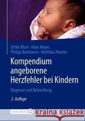 Kompendium Angeborene Herzfehler Bei Kindern: Diagnose Und Behandlung Blum, Ulrike 9783662612880 Springer