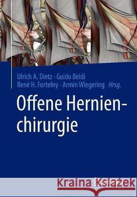 Offene Hernienchirurgie Ulrich A. Dietz Guido Beldi Ren 9783662613474 Springer