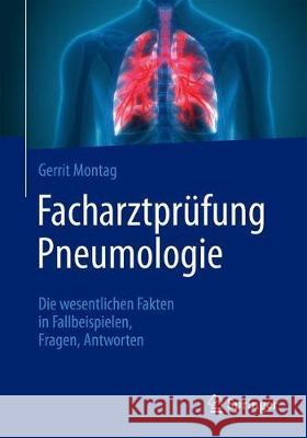 Facharztprüfung Pneumologie: Die Wesentlichen Fakten in Fallbeispielen, Fragen, Antworten Montag, Gerrit 9783662615737 Springer