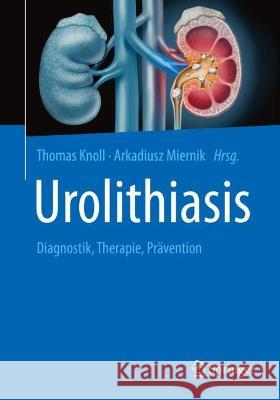 Urolithiasis: Diagnostik, Therapie, Prävention Knoll, Thomas 9783662624531 Springer