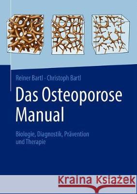 Das Osteoporose Manual: Biologie, Diagnostik, Prävention Und Therapie Bartl, Reiner 9783662625279 Springer