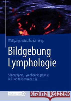 Bildgebung Lymphologie: Sonographie, Lymphangiographie, MR Und Nuklearmedizin Brauer, Wolfgang Justus 9783662625293 Springer