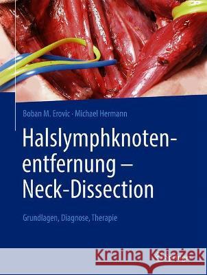 Halslymphknotenentfernung - Neck-Dissection: Grundlagen, Diagnostik, Therapie Erovic, Boban M. 9783662625651 Springer