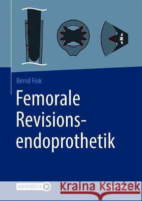Femorale Revisionsendoprothetik Bernd Fink 9783662629536 Springer