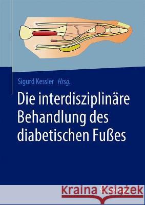 Die Interdisziplinäre Behandlung Des Diabetischen Fußes Kessler, Sigurd 9783662631188 Springer