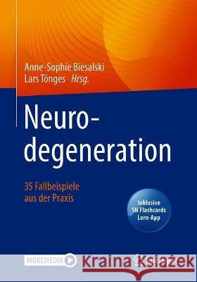 Neurodegeneration - 35 Fallbeispiele Aus Der Praxis Anne-Sophie Biesalski Lars T 9783662633083 Springer