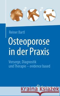 Osteoporose in Der Praxis: Vorsorge, Diagnostik Und Therapie - Evidence Based Bartl, Reiner 9783662642061