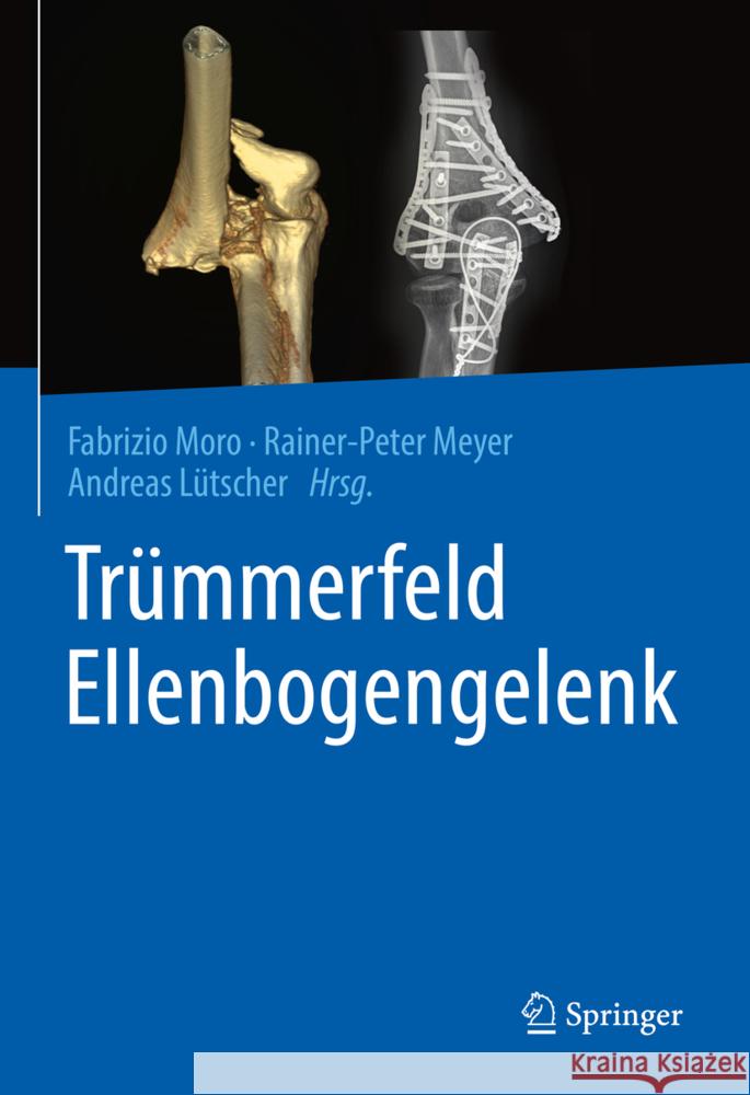 Trümmerfeld Ellenbogengelenk  9783662645376 Springer Berlin Heidelberg
