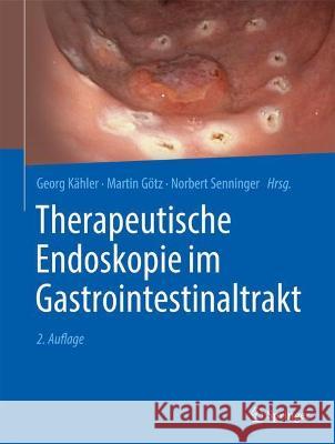 Therapeutische Endoskopie im Gastrointestinaltrakt Georg K?hler Martin G?tz Norbert Senninger 9783662650868