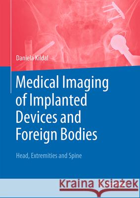 Medical Foreign Bodies in Imaging: Head, Extremities and Spine Daniela Kildal 9783662654484