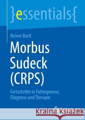 Morbus Sudeck (Crps): Fortschritte in Pathogenese, Diagnose Und Therapie Bartl, Reiner 9783662660126 Springer Berlin Heidelberg