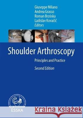 Shoulder Arthroscopy: Principles and Practice Giuseppe Milano Andrea Grasso Roman Brz?ska 9783662668672 Springer