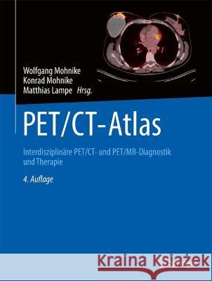 Pet/Ct-Atlas: Interdisziplin?re Pet/Ct- Und Pet/Mr-Diagnostik Und Therapie Wolfgang Mohnike Konrad Mohnike Matthias Lampe 9783662671917 Springer
