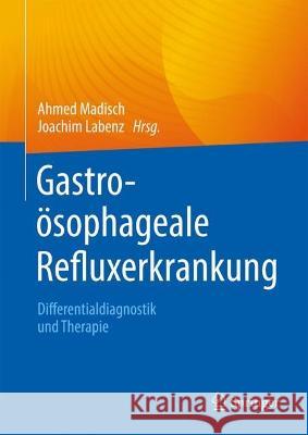 Gastroösophageale Refluxerkrankung: Differentialdiagnostik und Therapie Ahmed Madisch Joachim Labenz 9783662672341 Springer