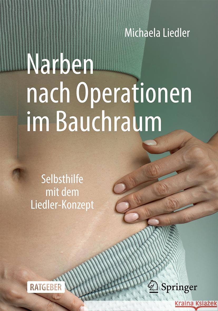 Narben Nach Operationen Im Bauchraum: Selbsthilfe Mit Dem Liedler-Konzept Michaela Liedler 9783662684818 Springer