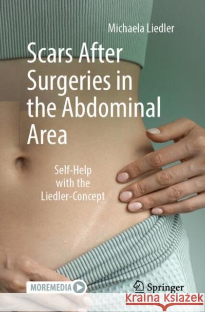 Scars After Surgeries in the Abdominal Area: Self-Help with the Liedler-Concept Liedler, Michaela 9783662713761 Springer
