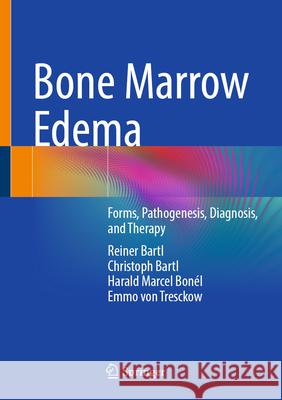 Bone Marrow Edema: Forms, Pathogenesis, Diagnosis, and Therapy Reiner Bartl Christoph Bartl Harald Marcel Bon?l 9783662723203 Springer