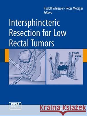 Intersphincteric Resection for Low Rectal Tumors Rudolf Schiessel Peter Metzger 9783709109281