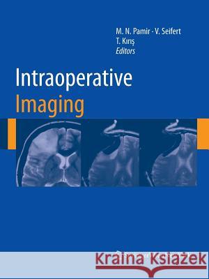 Intraoperative Imaging M. Necmettin Pamir Volker Seifert Talat Kiris 9783709111093 Springer