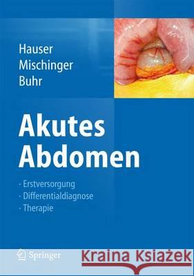 Akutes Abdomen: Diagnose - Differenzialdiagnose - Erstversorgung - Therapie Hauser, Hubert 9783709114728 Springer
