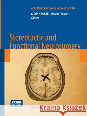 Stereotactic and Functional Neurosurgery Guido Nikkhah Marcus Pinsker 9783709116685