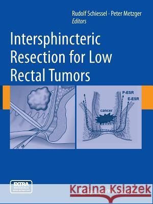 Intersphincteric Resection for Low Rectal Tumors Rudolf Schiessel Peter Metzger 9783709117231 Springer
