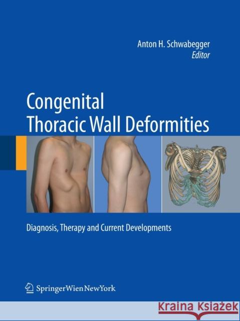 Congenital Thoracic Wall Deformities: Diagnosis, Therapy and Current Developments Schwabegger, Anton H. 9783709119105 Springer