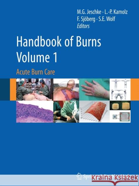 Handbook of Burns, Volume 1: Acute Burn Care Jeschke, Marc G. 9783709119181