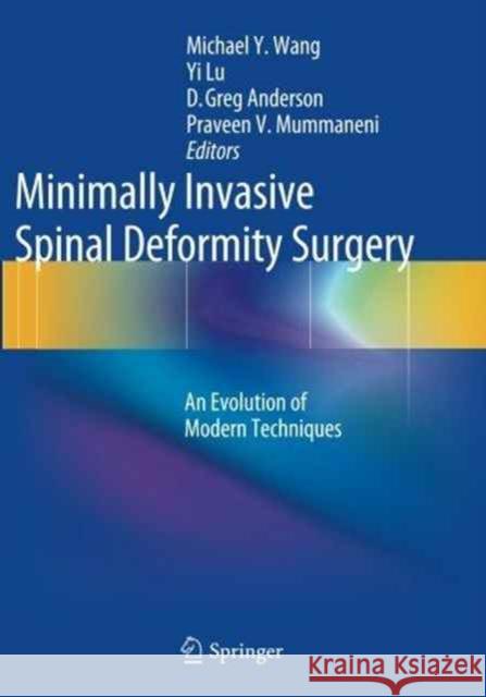 Minimally Invasive Spinal Deformity Surgery: An Evolution of Modern Techniques Wang, Michael y. 9783709119723 Springer