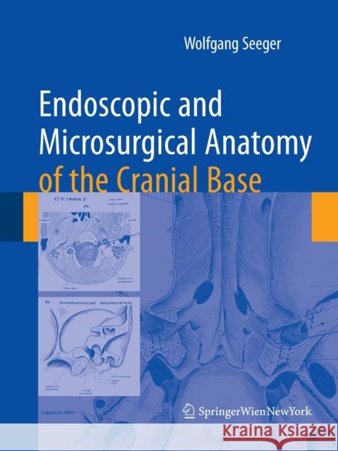 Endoscopic and Microsurgical Anatomy of the Cranial Base Seeger, Wolfgang 9783709120064 Springer