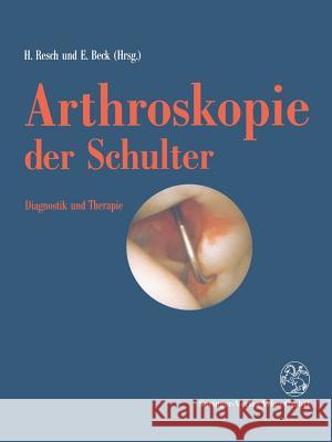 Arthroskopie Der Schulter: Diagnostik Und Therapie Resch, Herbert 9783709122839 Springer