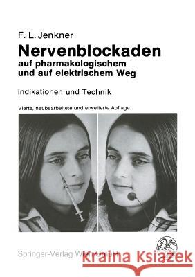 Nervenblockaden Auf Pharmakologischem Und Auf Elektrischem Weg: Indikationen Und Technik Stelzel, M. 9783709170267 Springer