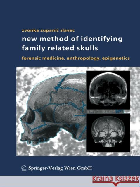 New Method of Identifying Family Related Skulls: Forensic Medicine, Anthropology, Epigenetics Zupanic Slavec, Zvonka 9783709172070 Springer