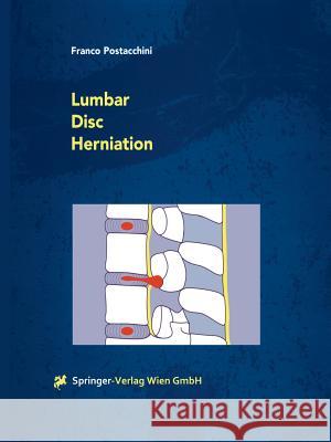 Lumbar Disc Herniation Franco Postacchini   9783709173220 Springer Verlag GmbH