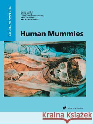 Human Mummies: A Global Survey of Their Status and the Techniques of Conservation Spindler, Konrad 9783709173527 Springer