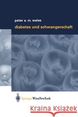 Diabetes Und Schwangerschaft Peter A. M. Weiss 9783709173954 Springer