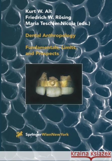 Dental Anthropology: Fundamentals, Limits and Prospects Alt, Kurt W. 9783709174982 Springer