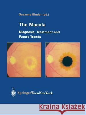 The Macula: Diagnosis, Treatment and Future Trends Binder, Susanne 9783709179871